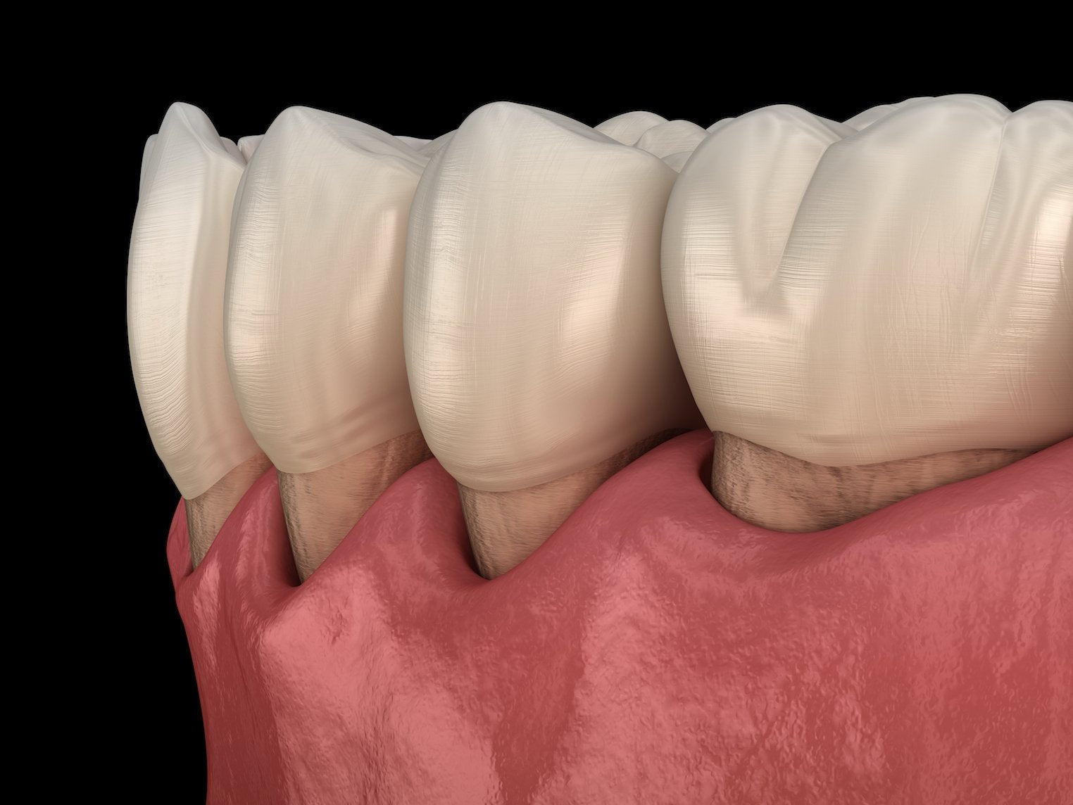 Preventing Gum Recession - BLU Toothbrush